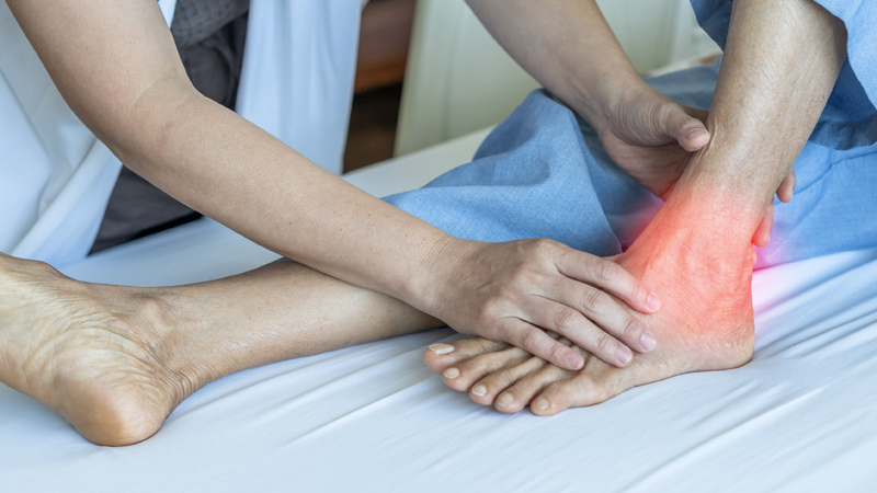 Achilles Tendon Injury