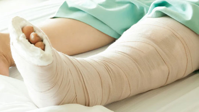 Complex Fracture Fixation