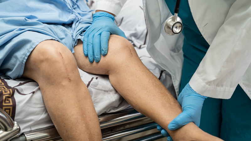 Minimal Invasive Joint Replacement