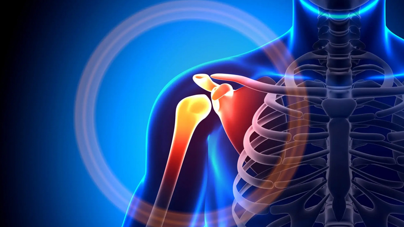 Shoulder Dislocation