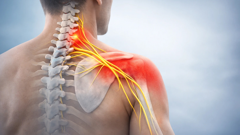 Shoulder Pain